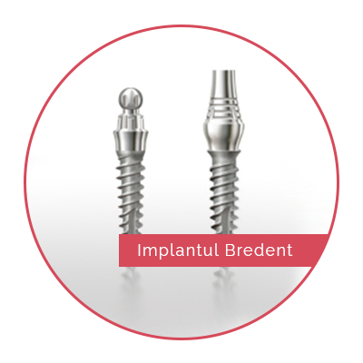bradent-impolant
